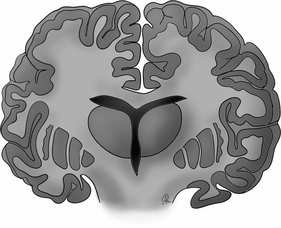 Scientific illustration of the brain